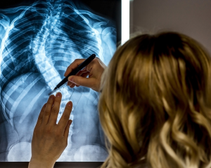 A healthcare professional examines a spinal X-ray, using a ruler and pen to measure spinal curvature, with signs of scoliosis visible.