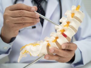 Doctor holding a spine model.