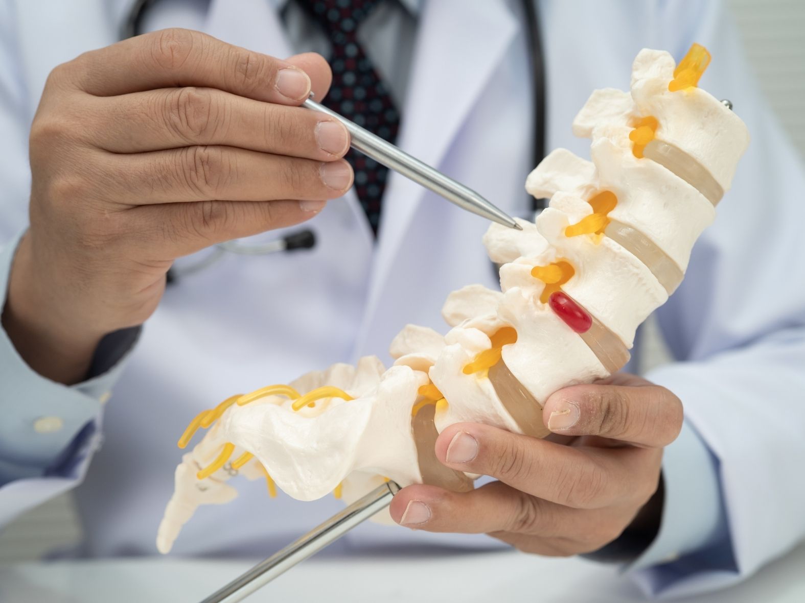 Doctor holding a spine model.